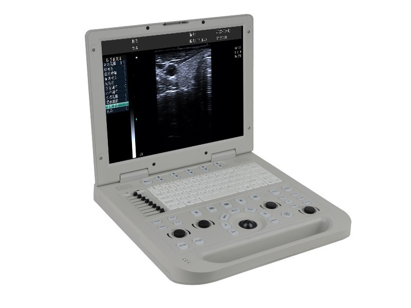 CS131 High-end Black and White Cardiac Ultrasound Machine - Precision Diagnostic Tool for Cardiac Care (4)