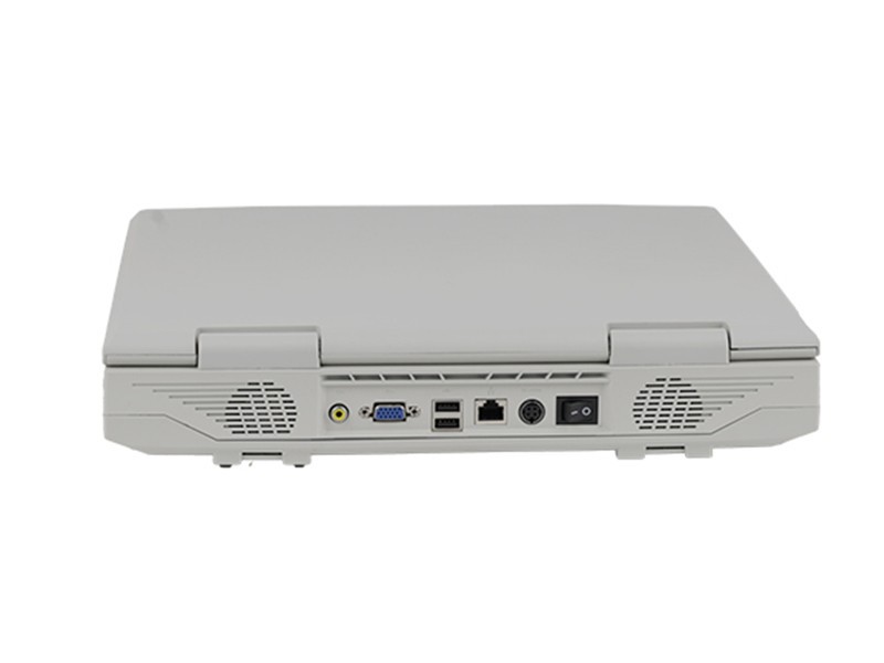 CS131 High-end Black and White Cardiac Ultrasound Machine - Precision Diagnostic Tool for Cardiac Care (5)