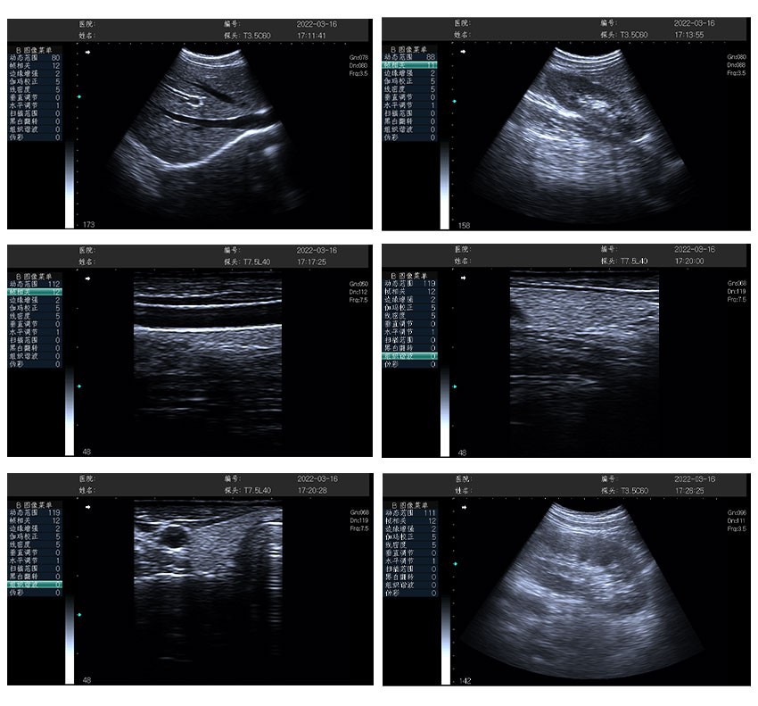 CS131 High-end Black and White Cardiac Ultrasound Machine - Precision Diagnostic Tool for Cardiac Care (7)