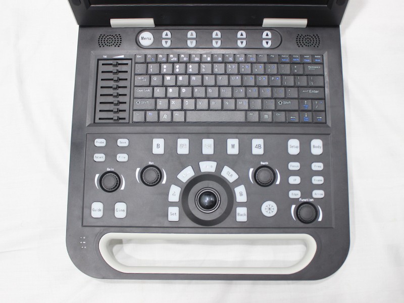 CS131 High-end Black and White Cardiac Ultrasound Machine - Precision Diagnostic Tool for Cardiac Care (2)